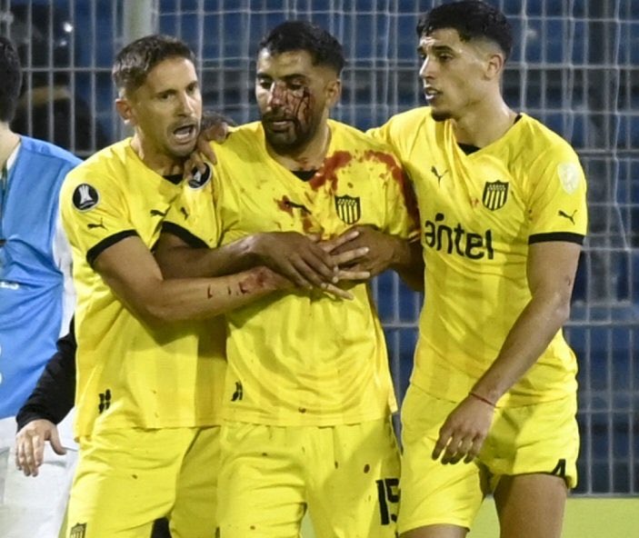 Escándalo: jugador de Peñarol recibió un corte tras ser agredido por un hincha de Central