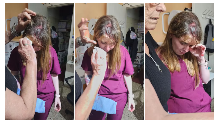 Córdoba: acusó a una veterinaria por la muerte de sus conejos y la atacó con una tenaza